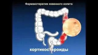 12 Фармакотерапия НЯК