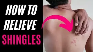 How To Relieve Shingles Pain