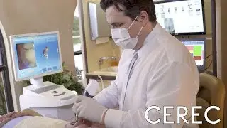 What is CEREC and why is it more accurate and convenient for patients?