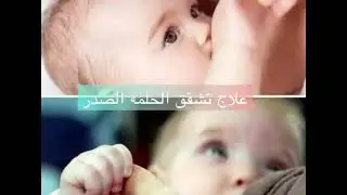 كريم جل تخفيف الم تشقق الحلمات للمميز ومش مضر لبيبى لو بلعو