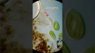 Вода в пруду под микроскопом (коловратки Trichocerca)