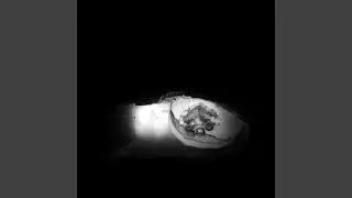 sedating white room surrounded by shadows
