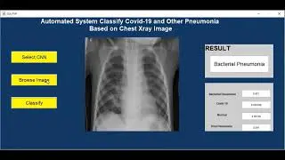 COVID-19 AND OTHER PNEUMONIA DEtECTION FROM CHEST X-RAY IMAGES USING CONVOLUTIONAL NEURAL NETWORK