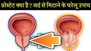 Prostate Ko Kam Karne Ke 4 Gharelu Upay || Prostate ka ilaj