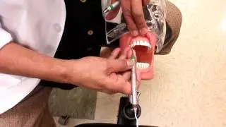 Rita Hernandez RDH 13   Max Anterior Facial Towards and Away Gracey 5 6