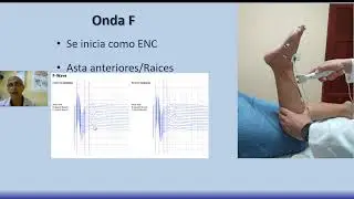 Electromiograf&iacute;a