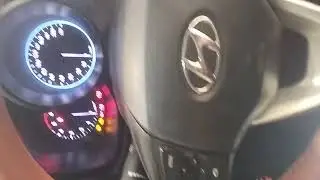 Hyundai venue steering angle sensor calibration 