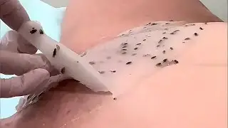Brazilian Vagina Bikini Waxing | Micro Bikini Intimate waxing tutorial #hairremoval #bikiniwax 