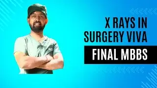 X RAYS IN SURGERY PRACTICAL EXAM FOR FINAL MBBS STUDENTS