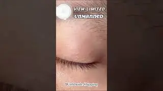 opoq linza xam kozga lichebnik kozga foydasi bor #asaka #linza #optika