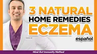 3 Natural Home Remedies [LUPUS CURE?] MD Specialist Explains - Spanish