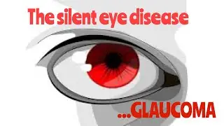 GLAUCOMA- The Silent Eye Disease