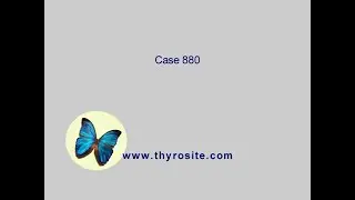 Case 880