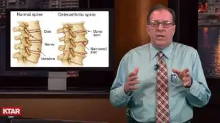 Health Update - Devils Claw can relieve lower back pain