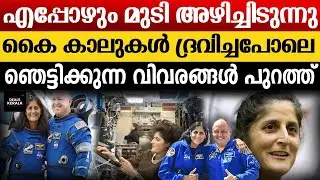 സുനിത വില്യംസിന് ആരോഗ്യ പ്രശ്നങ്ങൾ | വിഷാദ രോഗം | Space Health Challenges Revealed | NASA |  Space X