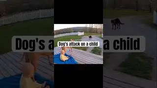 Dog's attack on a child