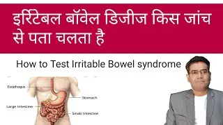 Irritable Bowel Syndrome is detected by which test? Tests for IBS.