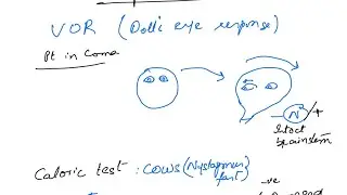 Vestibulo-ocular reflex and Caloric Test