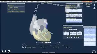 Introductory Epicardio Simulation lecture - ECG, PACING, CARDIAC EP
