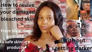 How to revive & repair damaged bleached skin/products to use+skincare tips to avoid getting darker