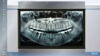 ClaimX & DXC Attachment Interface Training Video