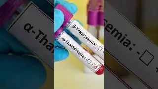 World Thalassemia Day: Dr. Chintan Vyas on Thalassemia Awareness and Prevention