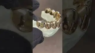 18k Gold Grillz By Fred: Are They Worth It?