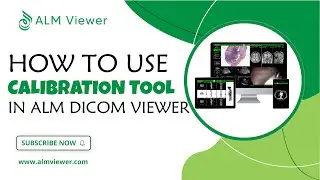 How to Use Calibration Tool in ALM Dicom Viewer | By Alm Viewer