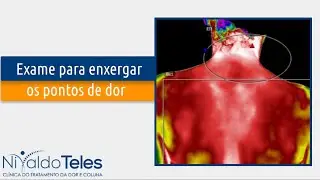 Um exame para enxergar a dor da fibromialgia. #Shorts