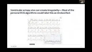 HEART MONITORING AT HOME: Dave Albert on the Wearable Tech Revolution (FEATURING @Alivecor)
