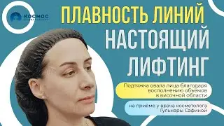 НАСТОЯЩИЙ ЛИФТИНГ ЛИЦА с помощью восполнения объёмов в височной области #советыкосметолога