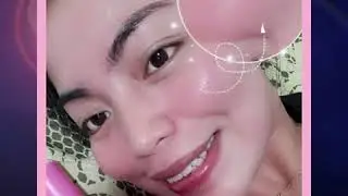 Fairy Skin Derma Facial set