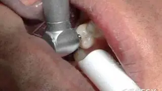 Technology Laser Hard Tissue