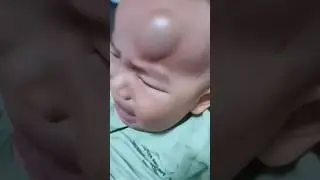 MIND-BLOWING Benefits of Adjustable Baby Helmets