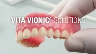 🔬 EN | VITA VIONIC&reg; SOLUTIONS | The Future of Digital Dentures is Here! 🌟