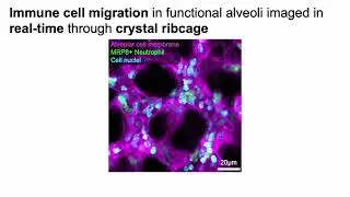 Real-time imaging of immune cells in crystal ribcage