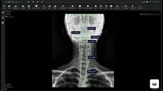 Voyance _ Nasium Xray Analysis