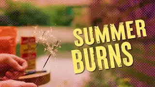 Summer Burn Safety