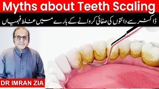 Myths about dental scaling | ڈاکٹر سے دانتوں کی صفائی کروانے کے بارے میں غلط فہمیاں | Dr Imran Zia