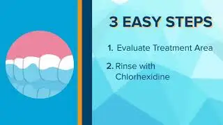 Propel Excellerator™ Series - See How It Works!