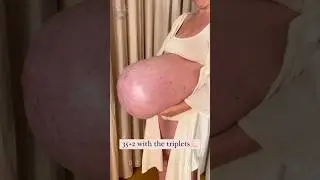 Perjuangan Seorang Ibu Buat Anaknya