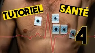 ECG (12 et 18 dérivations) - Tutoriel Santé