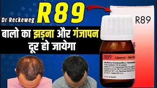 R89 Homeopathic Medicine ke Fayde : बालो का झड़ना रोके : Best Homeopathic Medicine for #Hairfall