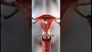 Why Periods Are Late or Missed | Medical Explanation (15s)#youtubeshorts #healthshorts #usashorts
