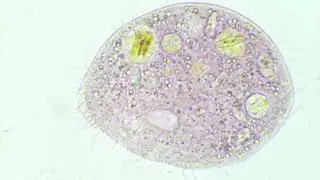 pink ciliate (a little bit squashed by the coverslip)