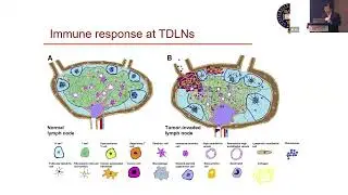 HIFU ablation and antitumour immune response