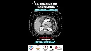TDM abdominale : radioanatomie et pathologie ft Dr Nabil Lahlou
