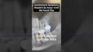 Autoimmune Symptoms Wouldn&rsquo;t Go Away&mdash;Until We Found This #shorts