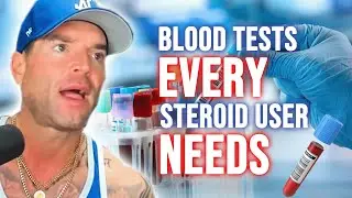 The blood tests every steroid user needs
