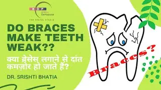 Do braces make teeth weak? क्या ब्रेसेस लगाने से दांत कमज़ोर हो जाते हैं? Dr. Srishti Bhatia